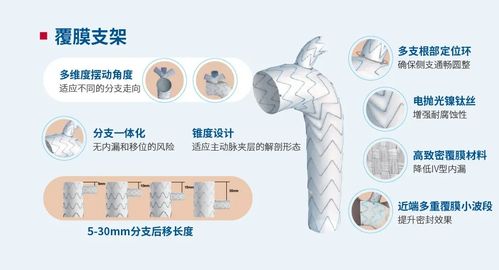 高值医械国产替代路 微创模式能走多远